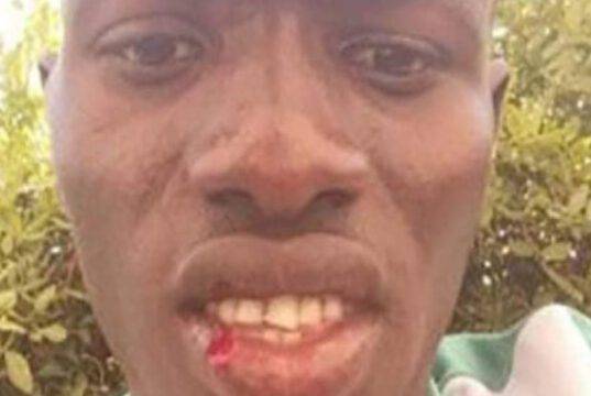Senegalese pestato nella civilissima Toscana. E il figlio implorava di non farlo Senegalese pestato nella civilissima Toscana. E il figlio implorava di non farlo
