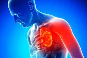 infarto