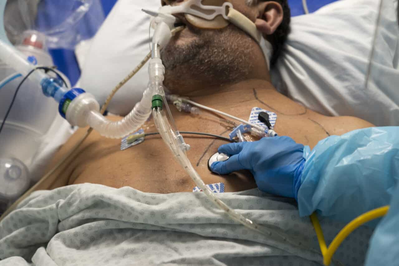 covid astrazeneca morti covid astrazeneca morti