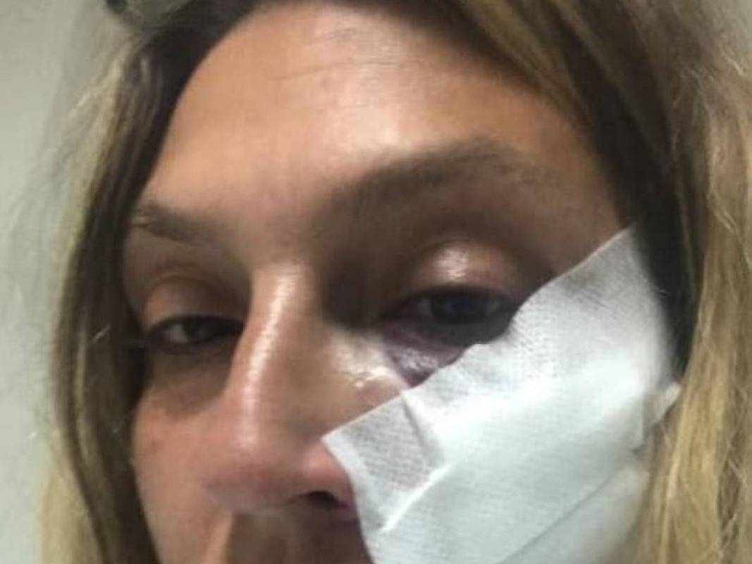 Picchiata in strada | nessuno mi ha aiutata Ho sentito rompersi i denti - Vimarsana News