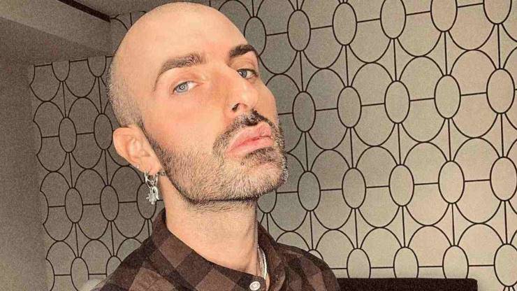 L'ex gieffino è irriconoscibile