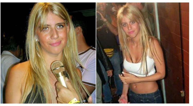 wanda nara chirurgo