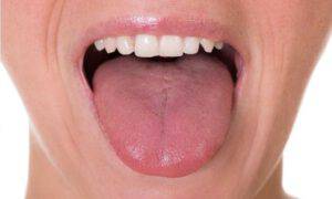 carenza vitamine lingua 