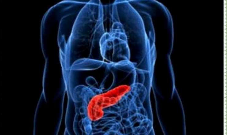 Cancro al pancreas