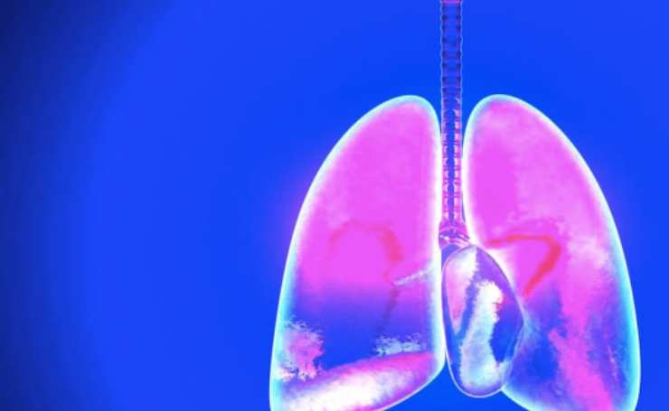 Cancro al polmone