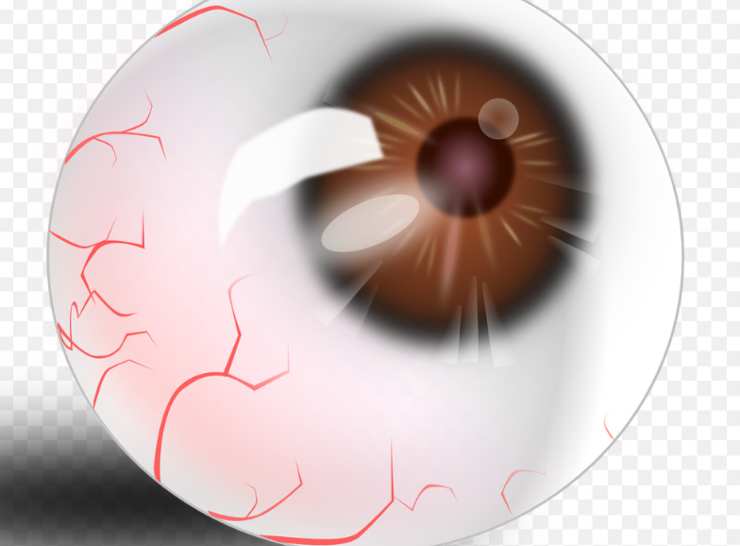 Pathologies of red eyes