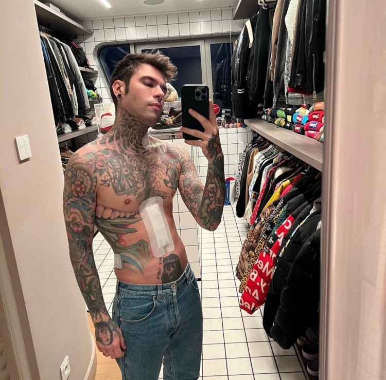 Fedez mostra la cicatrice (Instagram)