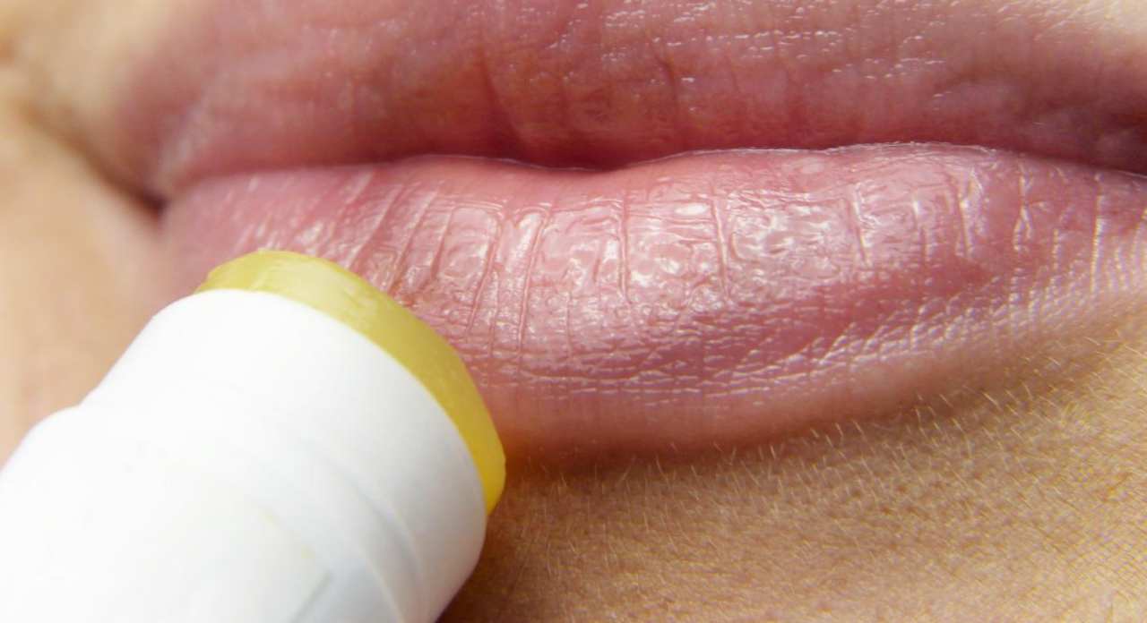 Herpes: se ne soffri sei più a rischio di diabete, lo studio shock Herpes: se ne soffri sei più a rischio di diabete, lo studio shock
