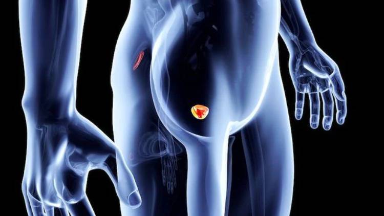 Prostate Cancer (Know Health)