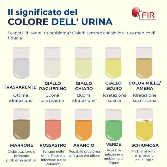 urine colore