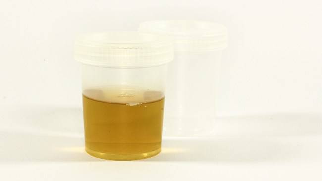 urine colore