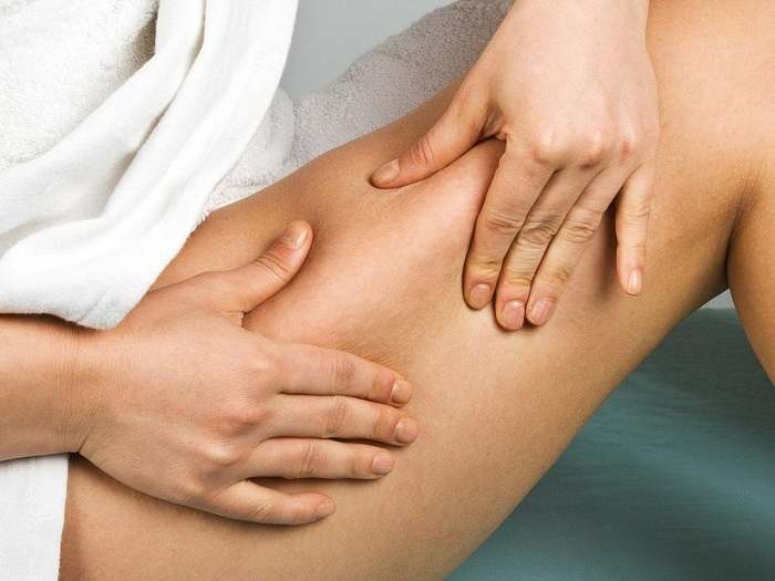 Cellulite: cercate di evitare questi alimenti