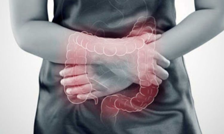 Tumore al colon: gli alimenti che possono aumentare le possibilità 8 Tumore al colorn cosa non mangiare